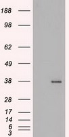 HEK293T cells were transfected with the