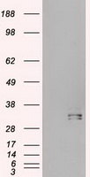 HEK293T cells were transfected with the
