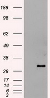 HEK293T cells were transfected with the