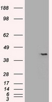 HEK293T cells were transfected with the
