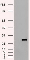 HEK293T cells were transfected with the