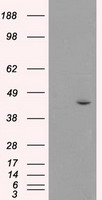 HEK293T cells were transfected with the