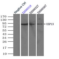 Immunoprecipitation (IP) of USP13 by usi