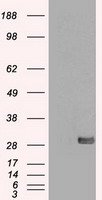 HEK293T cells were transfected with the
