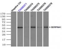 Immunoprecipitation (IP) of SERPINA1 by