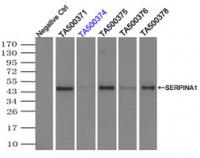 Immunoprecipitation (IP) of SERPINA1 by