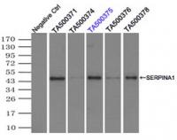 Immunoprecipitation (IP) of SERPINA1 by