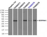 Immunoprecipitation (IP) of SERPINA1 by