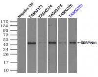 Immunoprecipitation (IP) of SERPINA1 by