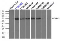 Immunoprecipitation (IP) of CHEK2 by usi