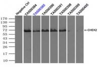 Immunoprecipitation (IP) of CHEK2 by usi