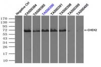 Immunoprecipitation (IP) of CHEK2 by usi