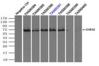 Immunoprecipitation (IP) of CHEK2 by usi