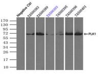 Immunoprecipitation (IP) of PLK1 by usin