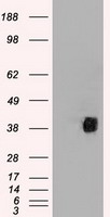 HEK293T cells were transfected with the