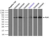 Immunoprecipitation (IP) of PLK1 by usin
