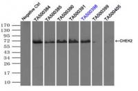 Immunoprecipitation (IP) of CHEK2 by usi