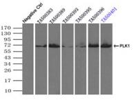 Immunoprecipitation (IP) of PLK1 by usin
