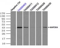 Immunoprecipitation (IP) of MAP2K4 by us