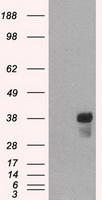 HEK293T cells were transfected with the