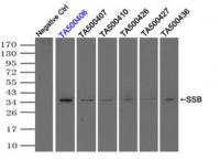 Immunoprecipitation (IP) of SSB by using