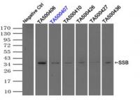 Immunoprecipitation (IP) of SSB by using