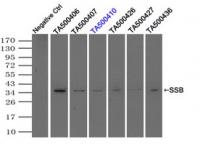 Immunoprecipitation (IP) of SSB by using