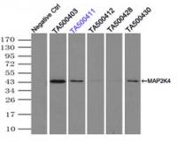 Immunoprecipitation (IP) of MAP2K4 by us