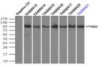 Immunoprecipitation (IP) of TYRO3 by usi
